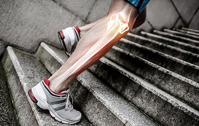 سلامتی مفاصل